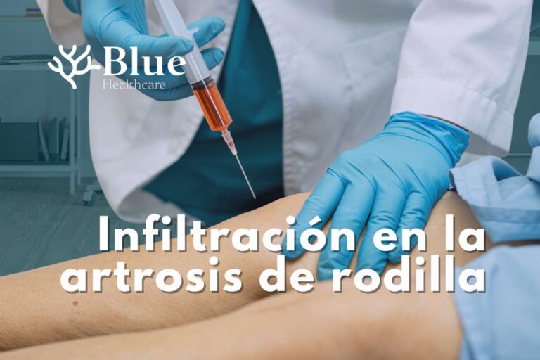Infiltración ecoguiada en la rodilla de un paciente con artrosis