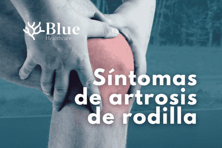 Dolor al caminar: síntoma frecuente de artrosis de rodilla