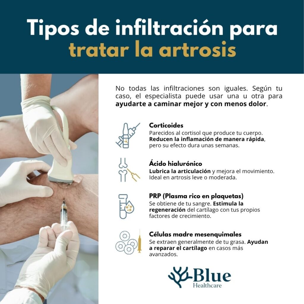 Infografía sobre infiltración ecoguiada en pacientes con artrosis de rodilla