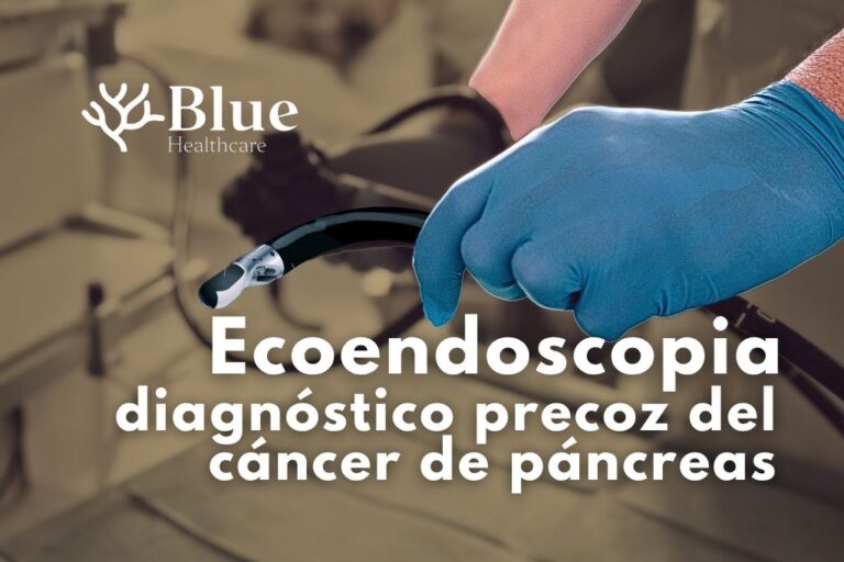 Especialista a punto de realizar ecoendoscopia a paciente con sospecha de cáncer de páncreas