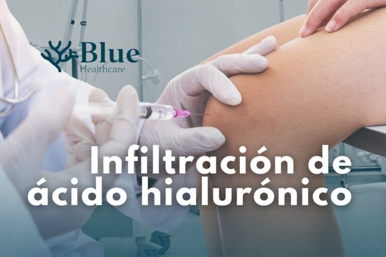 Texto alternativo (alt text): Médico realizando infiltración de ácido hialurónico en la rodilla para aliviar dolor por artrosis