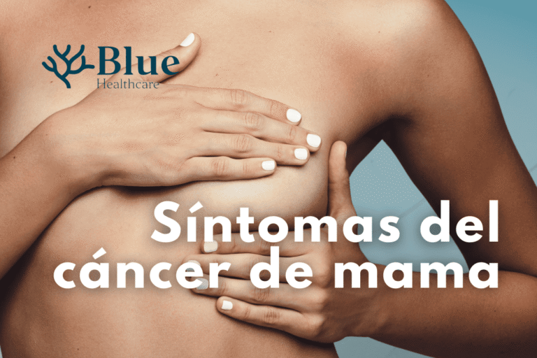 Mujer realizando autoexploración mamaria para detectar síntomas de cáncer de mama.