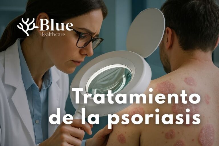 tratamiento psoriasis