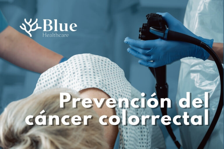 Paciente sedada durante una colonoscopia, realizada por un equipo de especialistas en Aparato Digestivo como cribado del cáncer de colon.