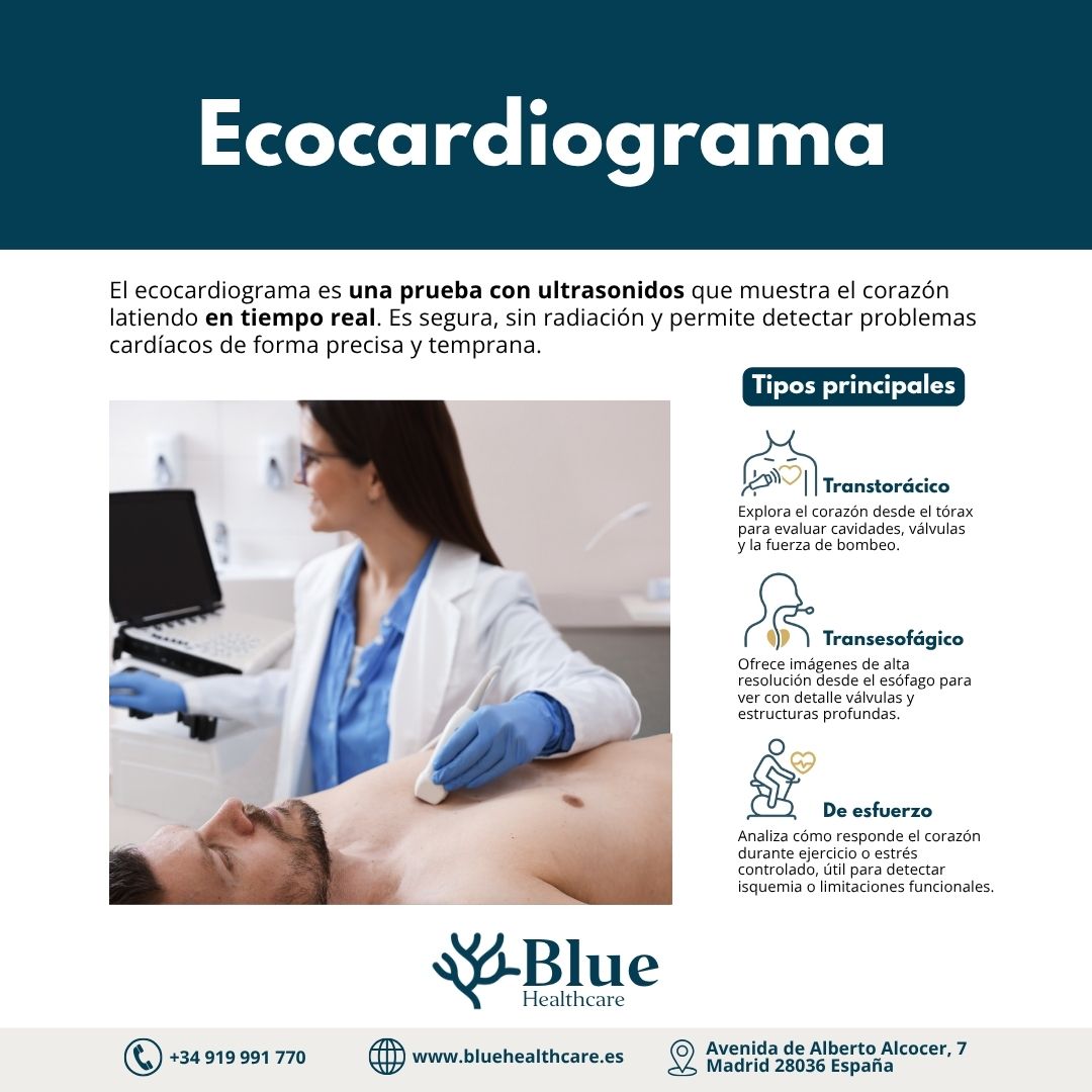Ecocardiograma: qué es, cuándo se indica y qué revela
