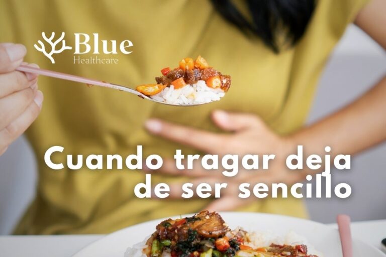 Mujer con dificultad para tragar mientras come, síntoma típico de acalasia.