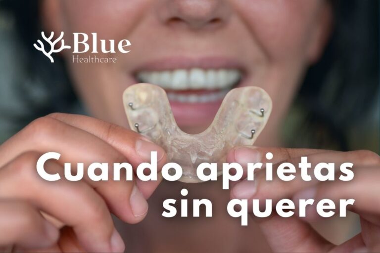 Mujer con bruxismo mostrando su férula de descarga mientras toca la mandíbula con gesto de molestia.