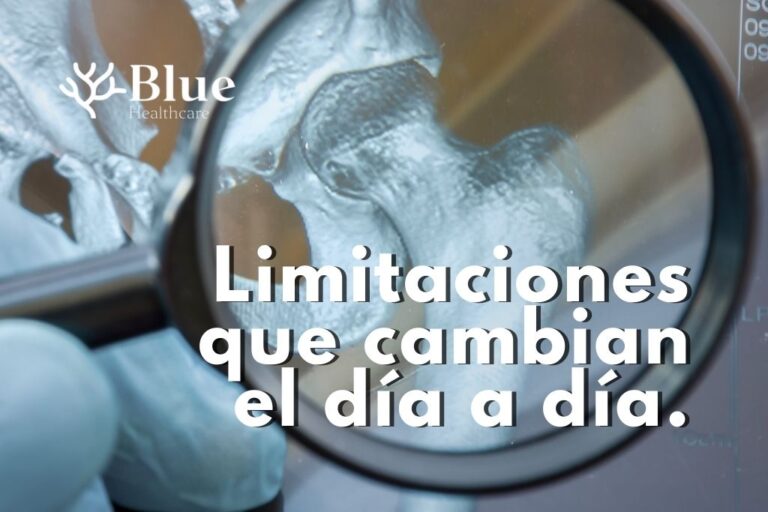 Médico observando una radiografía de cadera con desgaste articular, símbolo de limitación y movilidad reducida.