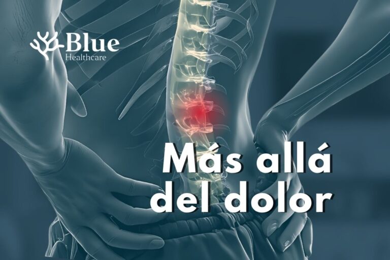 Infografía médica que explica qué es una hernia discal, sus tipos según la localización y por qué puede no causar dolor