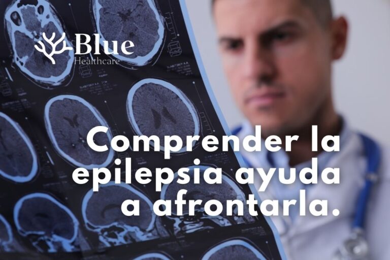 Imagen médica que ilustra la epilepsia y la importancia de comprender esta enfermedad neurológica.