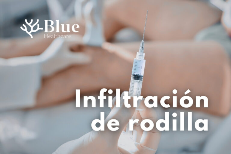 Infiltración de rodilla realizada mediante guía ecográfica para tratamiento del dolor articular
