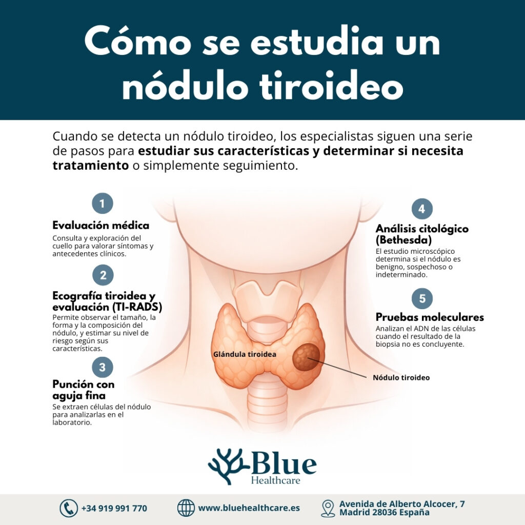 Infografía sobre tratamientos del nódulo tiroideo: seguimiento, radiofrecuencia, etanolización y cirugía