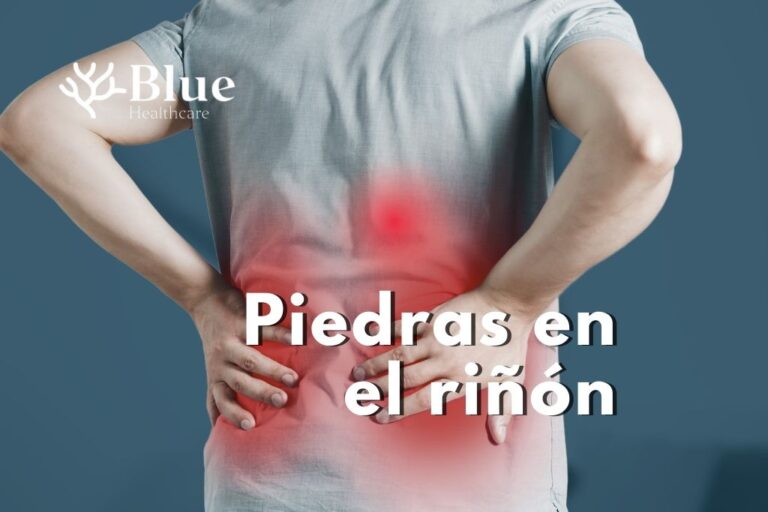 Hombre con dolor lumbar causado por piedras en el riñón o cálculos renales